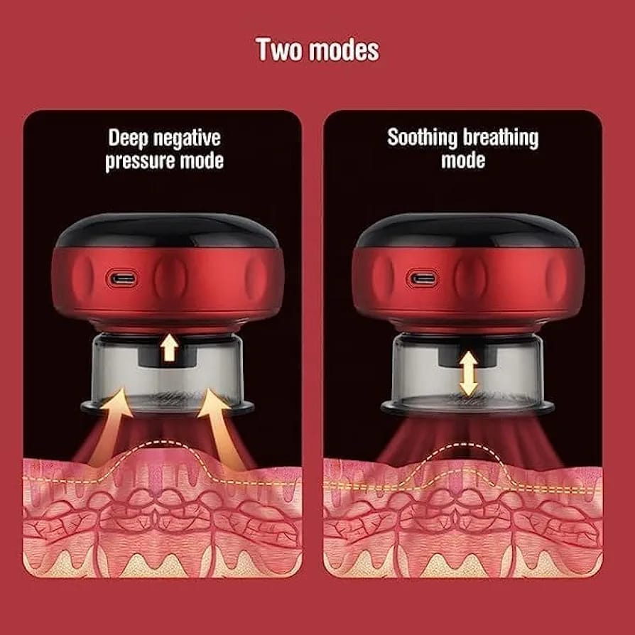 Electric Cupping Therapy