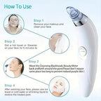 4 in 1 Multi-Function Blackhead Whitehead Extractor Remover Device