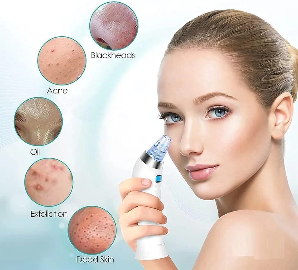 4 in 1 Multi-Function Blackhead Whitehead Extractor Remover Device