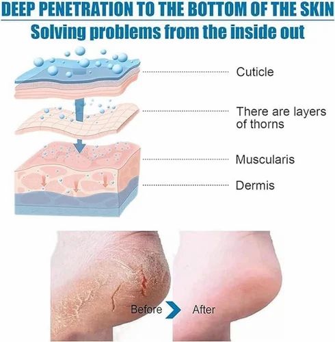 Foot Peel Mask