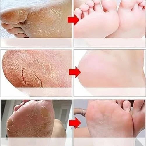 Foot Peel Mask
